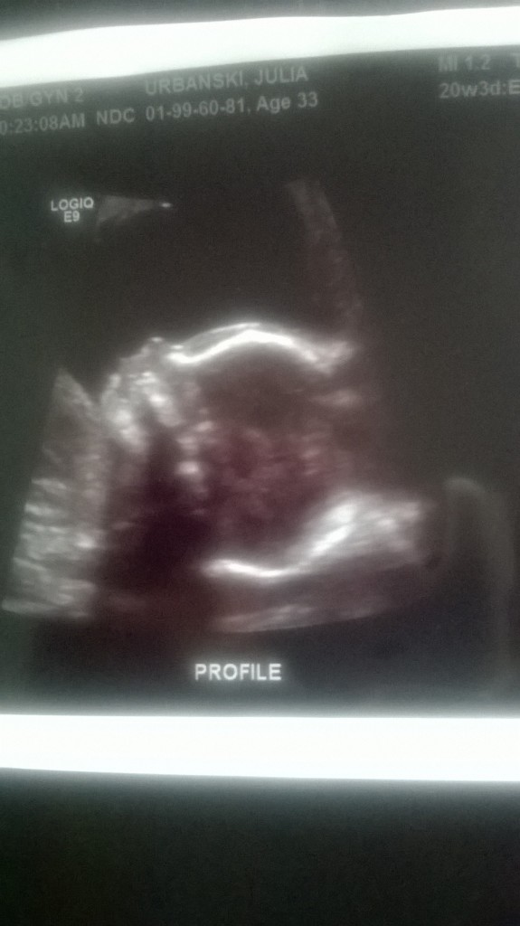 Here is our little guy at 20 weeks. 